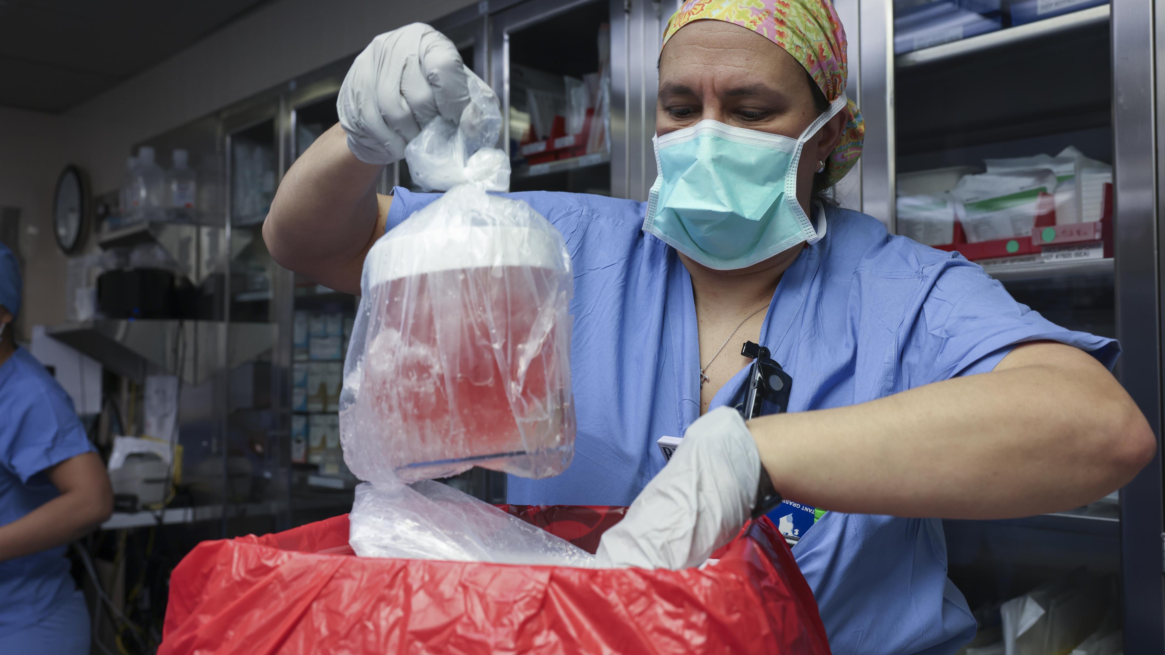 Erst vor wenigen Wochen hatte der 62-Jährige die Schweineniere implantiert bekommen. Hier nimmt eine Krankenschwester das Organ aus der Kühlbox. 