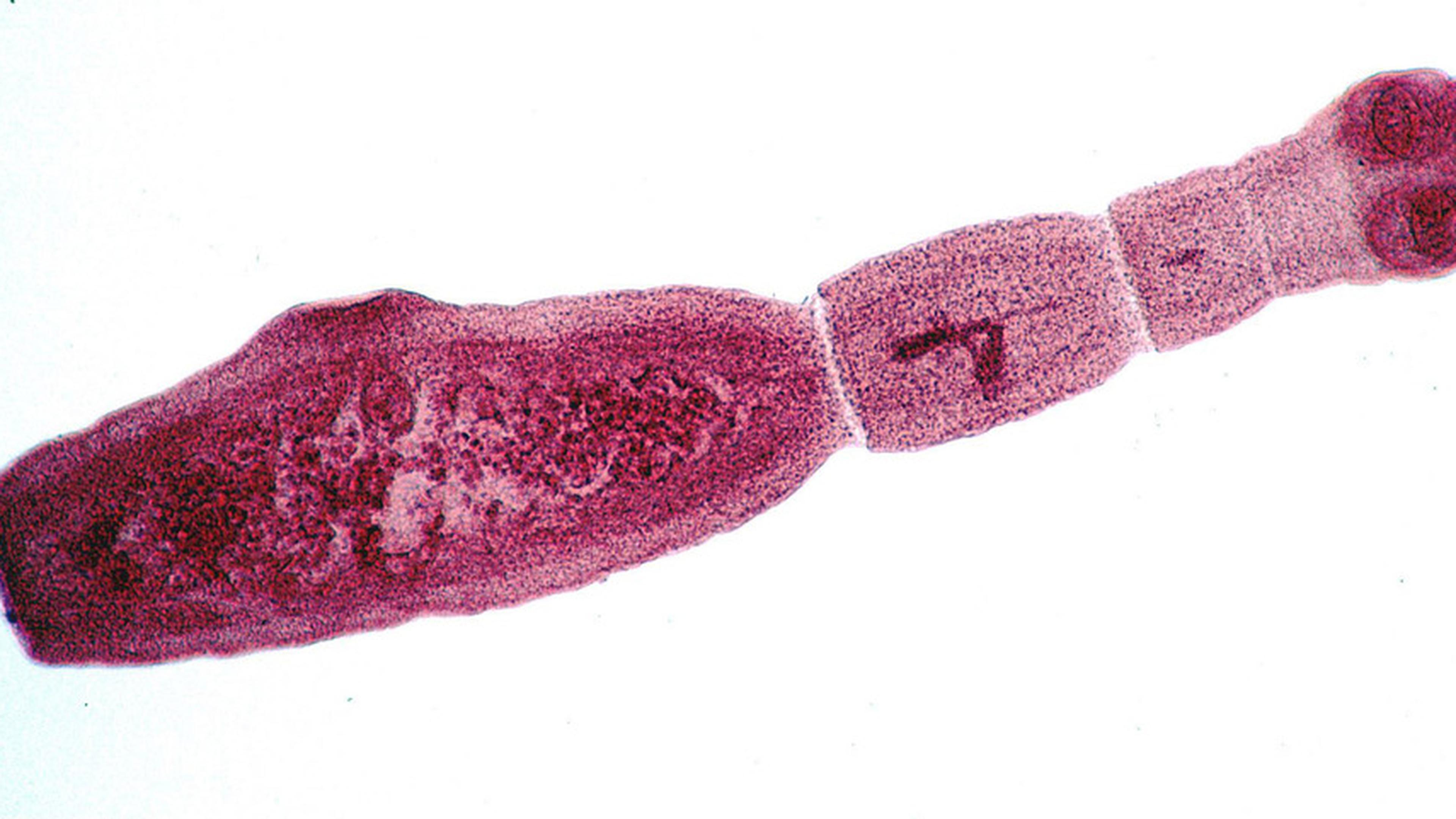 Эхинококк. Ленточные черви эхинококк. Ленточный червь эхинококк.