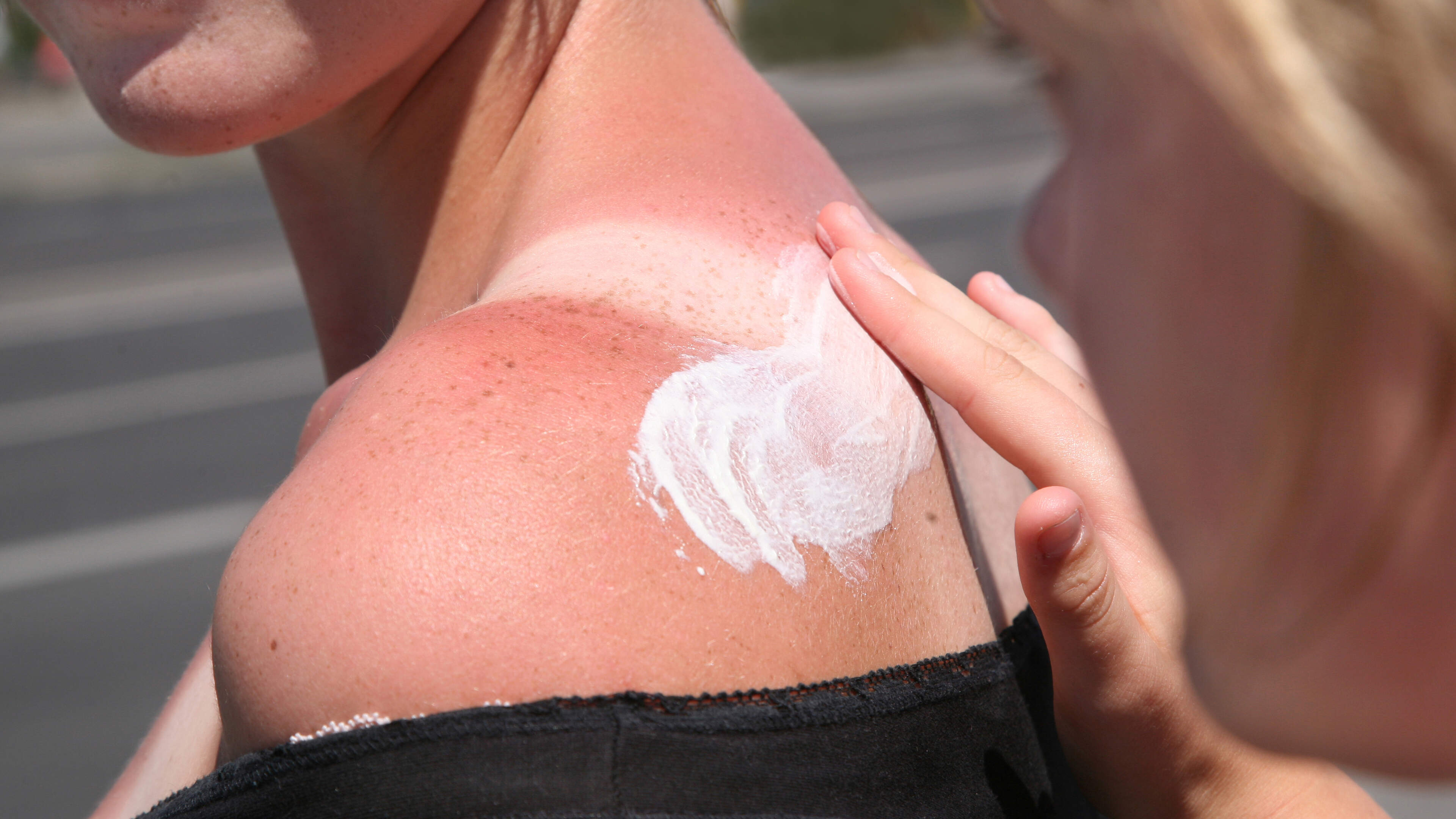 Sommer, Sonne, Sonnenbrand: 8 Sonnenschutz-Mythen 